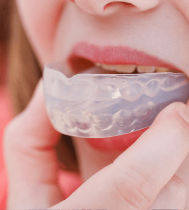 Professionally made Mouthguards